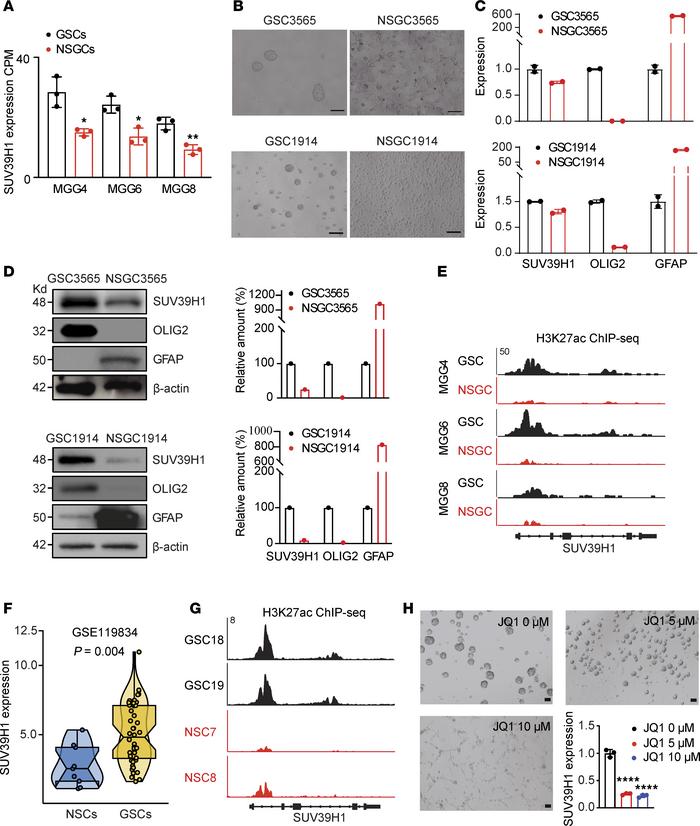 SUV39H1 expression in GSCs, NSGCs, and normal brain cells.
(A) Analysis ...