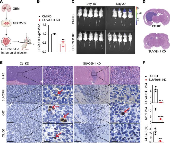 Targeting SUV39H1 decreases GSC-driven GBM growth in mice.
(A) Schematic...