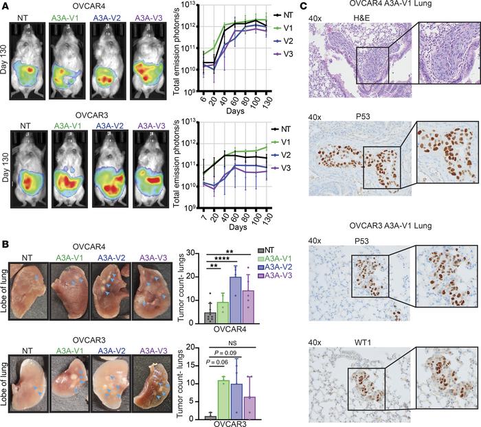 A3A promotes distant HGSOC metastasis in vivo.
(A) Representative images...