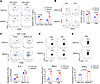 HDAC8 deletion enhances the proliferation and function of CD4+ and CD8+ T c