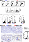 CD4+ T cells are necessary for the development of anti–PD-L1 therapy–induce