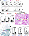 Reconstitution of pathogenic CD4+ T cells induces lung damage in T cell–def