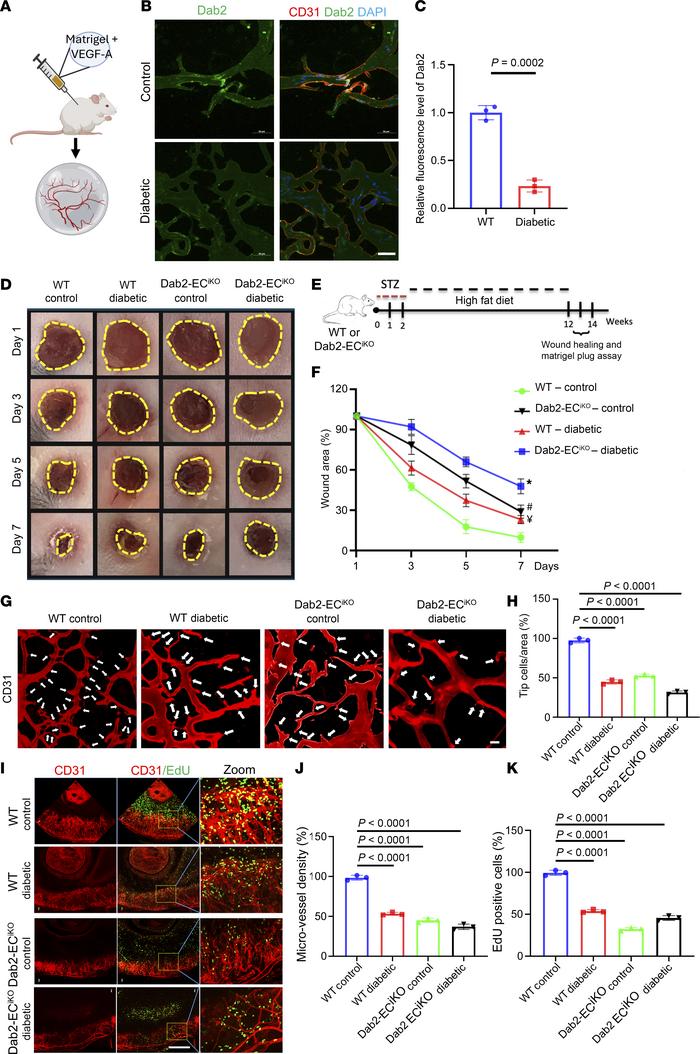 EC-specific Dab2 knockout causes reduced angiogenesis in vivo.
(A) Schem...