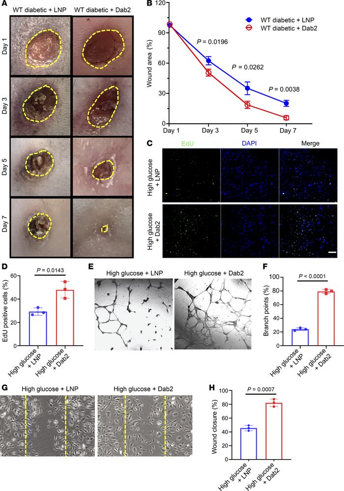 Restoration of Dab2 expression in ECs rescues impaired angiogenesis and ...