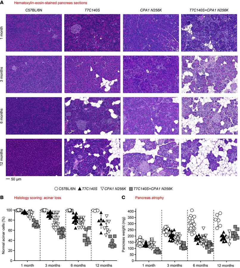Pancreas histology and pancreas weight in C57BL/6N, T7C140S, CPA1 N256K,...