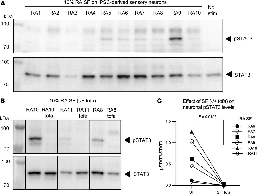 RA-derived synovial fluid can induce pSTAT3 in human sensory neuron cult...