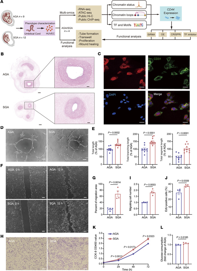Distinctive phenotypes of HUVECs derived from SGA and AGA individuals.
(...
