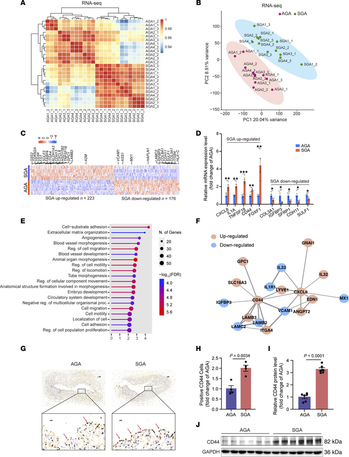 Dysregulation of angiogenic genes in SGA-HUVECs.
(A) Clustering of RNA-S...