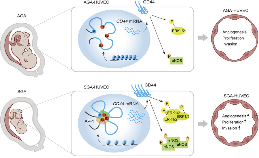 Proposed model for the epigenetic regulation mechanism of SGA-HUVECs’ dy...