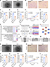 CD44 is a key regulator strengthening functions of SGA-HUVECs.
