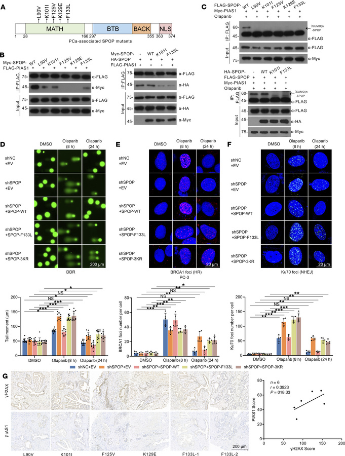 Dysregulation of CK2/PIAS1/SPOP axis leads to impaired DDR in PC-3 cells...