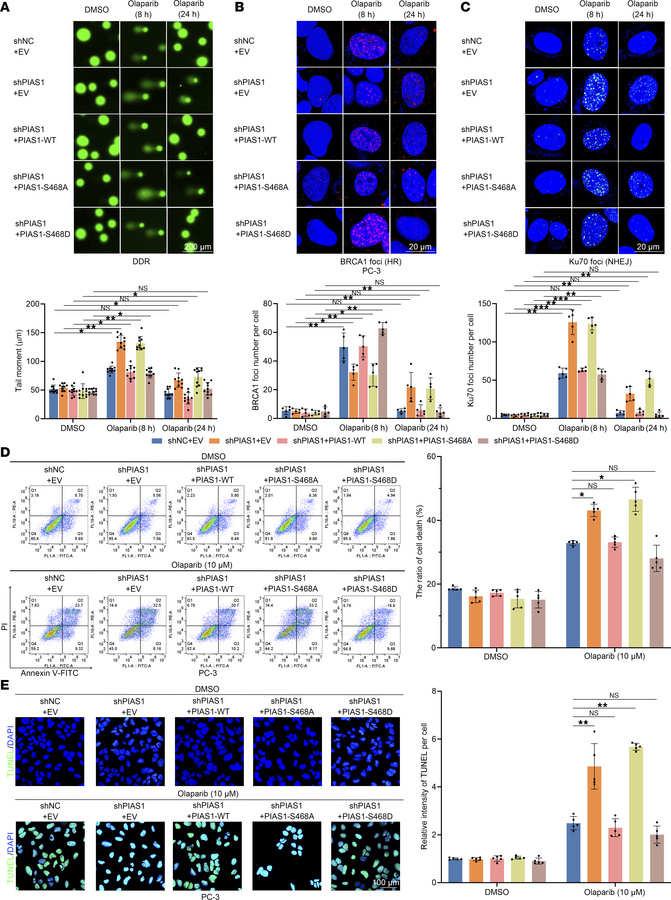 CK2-mediated phosphorylation of PIAS1-S468 increases DDR and inhibits ol...