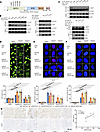 Dysregulation of CK2/PIAS1/SPOP axis leads to impaired DDR in PC-3 cells.