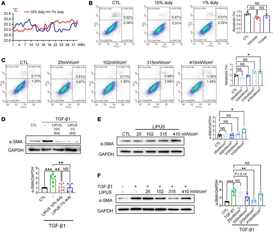 In vitro effect of LIPUS on MTECs and parameter selection for CKD treatm...