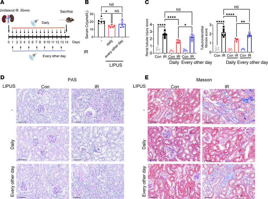 LIPUS parameter evaluation for IR-induced renal injury.
(A) Study protoc...
