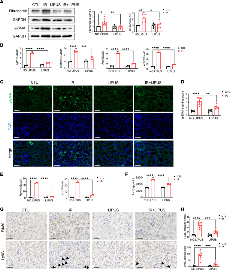 LIPUS protects from IR-induced renal injury.
(A) Protein levels of fibro...