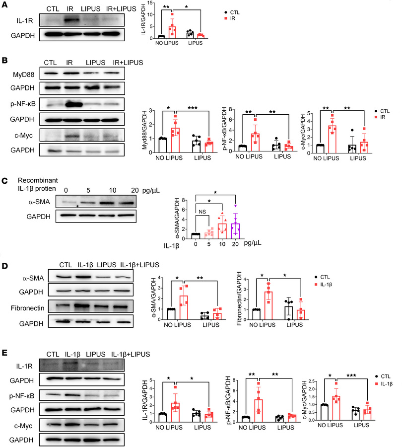 LIPUS downregulates IL-1R and its downstream genes.
(A) Protein level of...