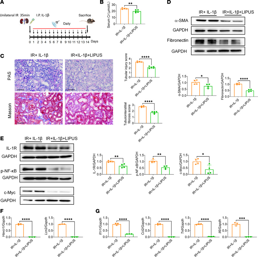 LIPUS ameliorates IL-1β–stimulated IR-induced renal injury.
(A) Study pr...