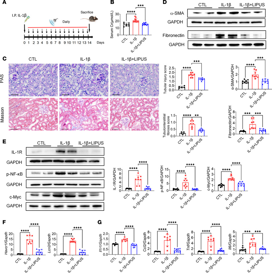 LIPUS protects from IL-1β–induced renal injury.
(A) Study protocol. (B) ...