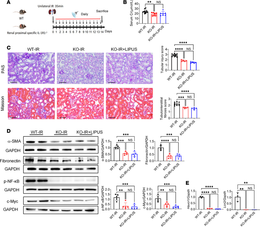 LIPUS treats CKD by regulating the tubular IL-1R signaling pathway.
(A) ...