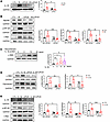 LIPUS downregulates IL-1R and its downstream genes.