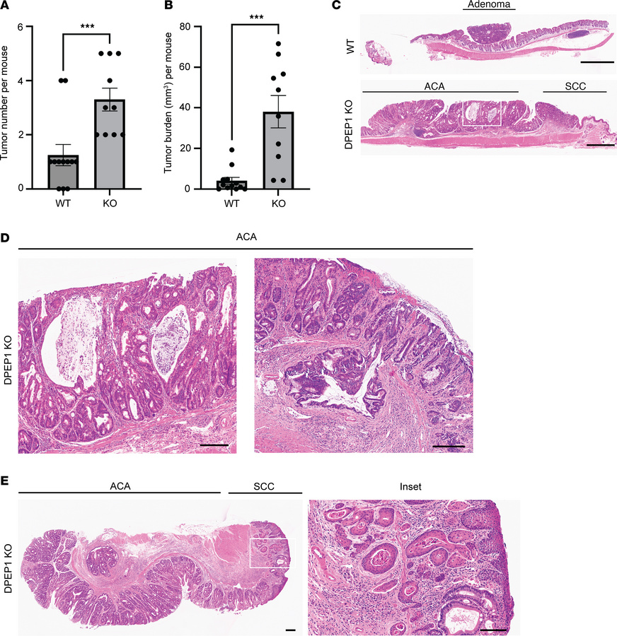 JCI Insight - Dipeptidase-1–knockout mice develop invasive tumors with ...