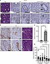 DPEP1 is linked to neutrophil presence and binding in CRC.