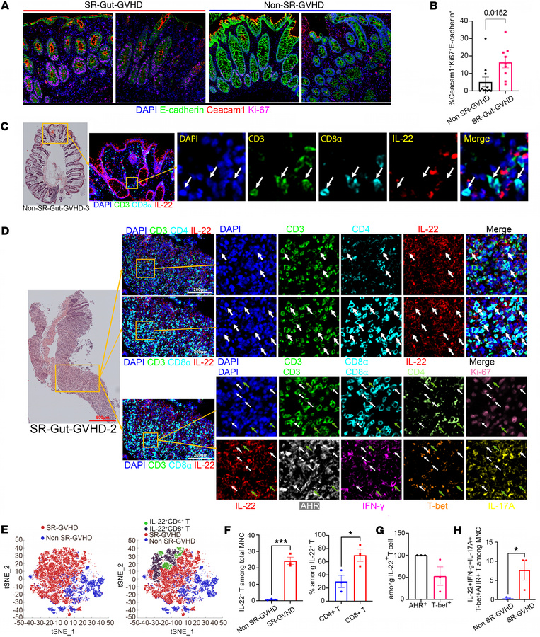 Colonic epithelial expression of CEACAM1 and infiltration of IL-22+IFN-γ...