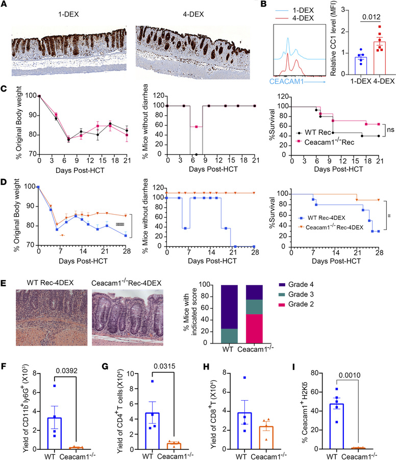 Host Ceacam1 deficiency ameliorates SR-Gut-aGVHD but not untreated GVHD....