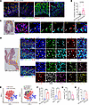 Colonic epithelial expression of CEACAM1 and infiltration of IL-22+IFN-γ+ T