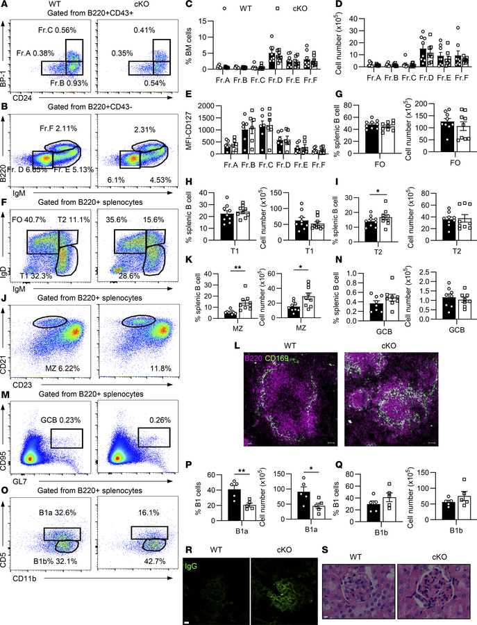HMGB1 is essential for differentiation of peripheral B cells and B1 cell...