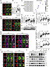 HMGB1 modulates BCR activation and proximal signaling.