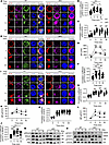 Hmgb1 deficiency enhances the activation of NF-κB and STAT5 while impairing