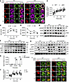 Hmgb1 deficiency promotes F-actin accumulation via the MST1/DOCK8/WASP axis