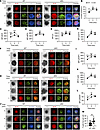 Hmgb1 deficiency enhances B cell spreading and BCR signalosome recruitment.
