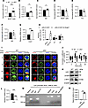HMGB1 negatively regulates Cd21 expression to inhibit the B cell activation