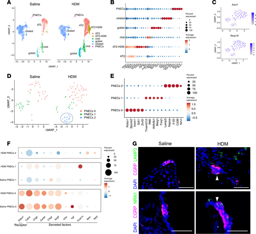 Single-cell transcriptomic characterization of epithelial cells with or ...