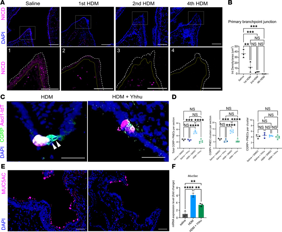 Downregulation of Notch signaling pathway contributes to PNEC increase f...