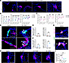 Proliferation and club cell transdifferentiation contribute to PNEC hyperpl