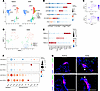 Single-cell transcriptomic characterization of epithelial cells with or wit