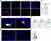 Downregulation of Notch signaling pathway contributes to PNEC increase foll