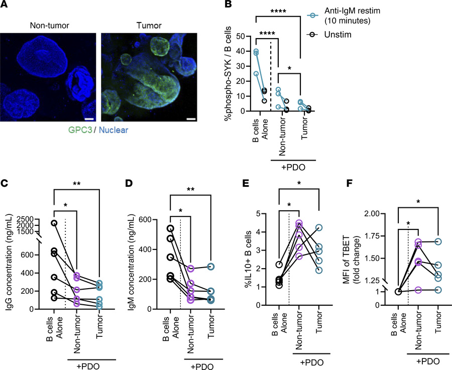 Patient-derived HCC organoids modulate B cell functionality in vitro.
(A...