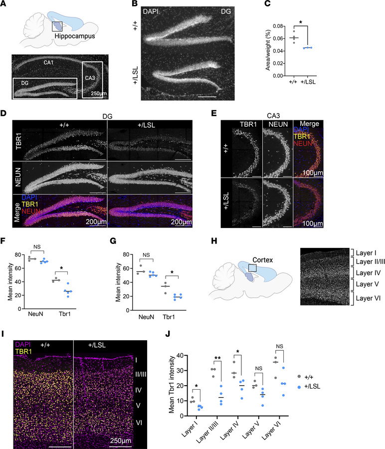 Neurological defects observed in the Kmt2a+/LSL mouse model.
(A) Schemat...