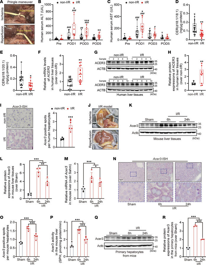 I/R activates ACER3-catalyzed ULCC hydrolysis in human and mouse liver.
...