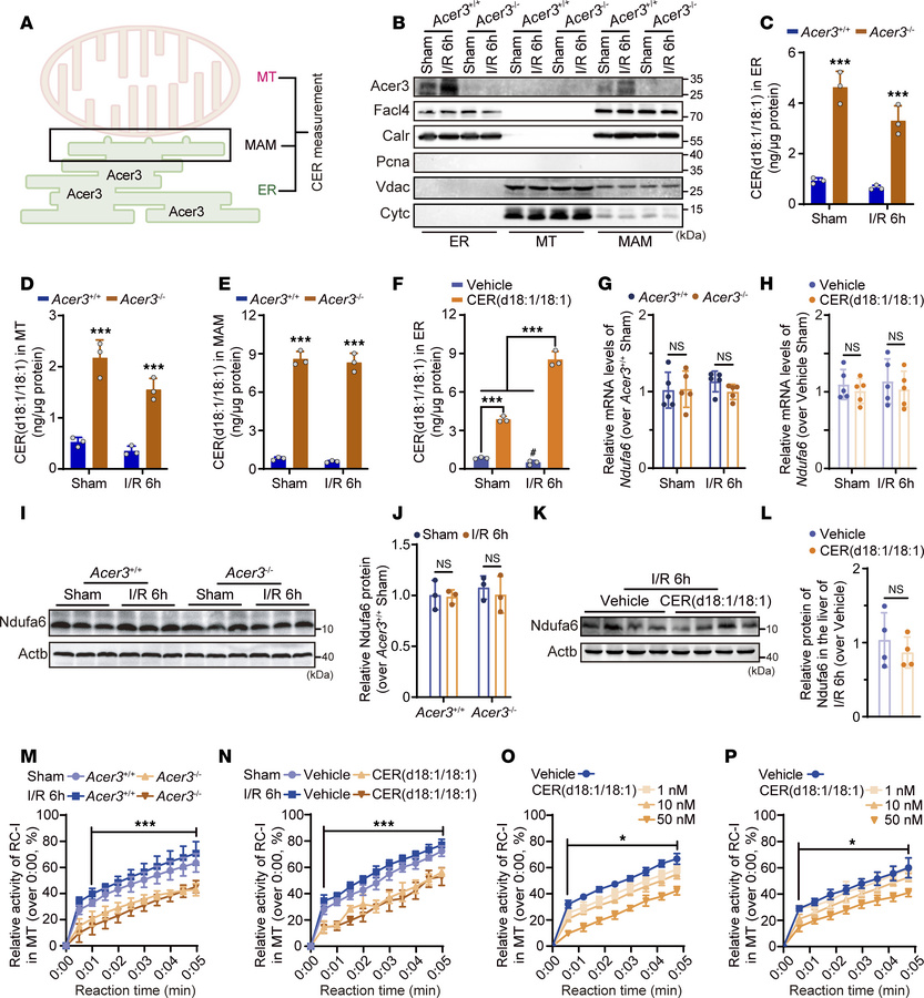 
Acer3 ablation and CER(d18:1/18:1) treatment inhibit RC-I activity in t...