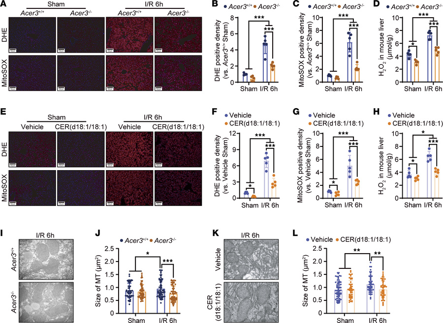
Acer3 ablation and CER(d18:1/18:1) treatment reduce ROS production and ...