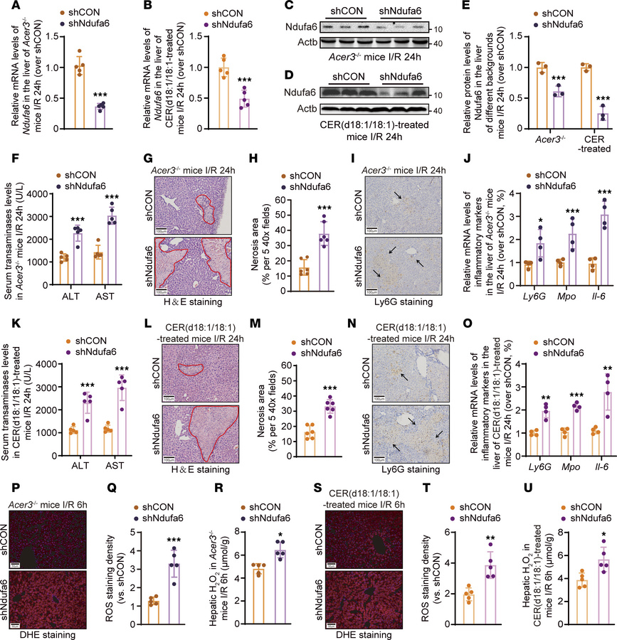 
Ndufa6 knockdown impairs the protective functions of Acer3 ablation and...