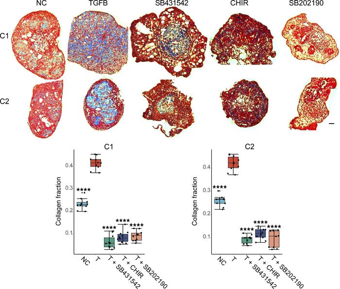 Antifibrotic drugs inhibit fibrosis in microHOs produced from iPSCs of d...