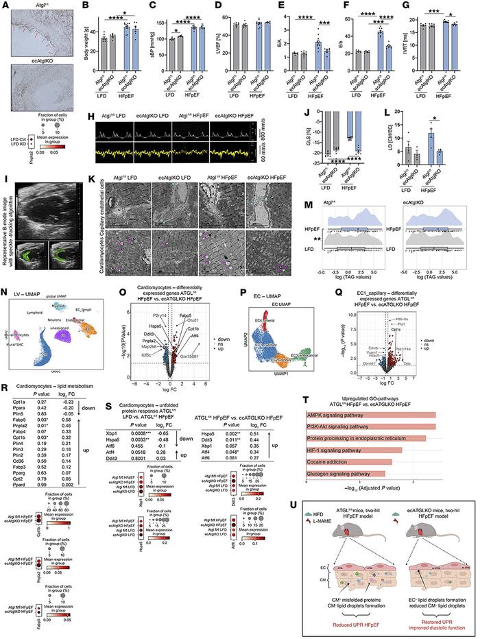 Endothelial deletion of ATGL protects against HFpEF.
(A) Representative ...