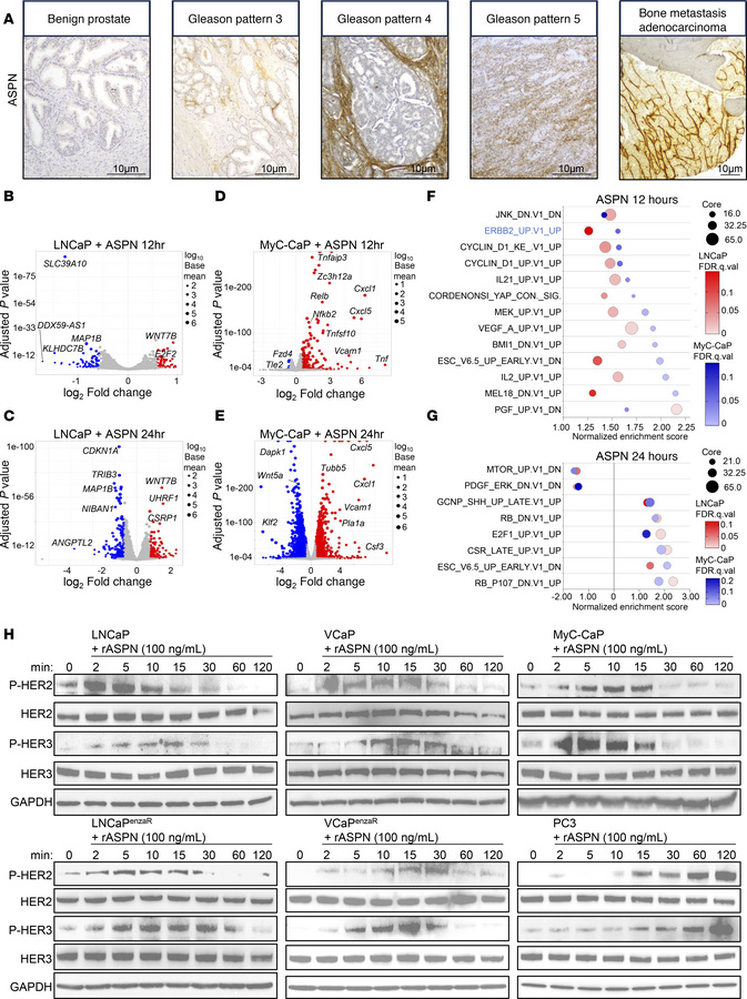 Stroma-secreted ASPN activates HER2/HER3 in prostate cancer cells.
(A) R...